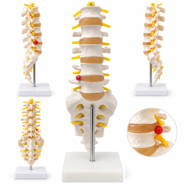 human-lumbar-spine-model-life-size-with-sacrum-and-herniated-disc
